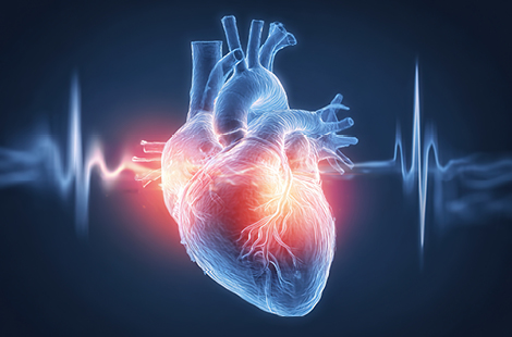 Photo of SCOMPENSO CARDIACO