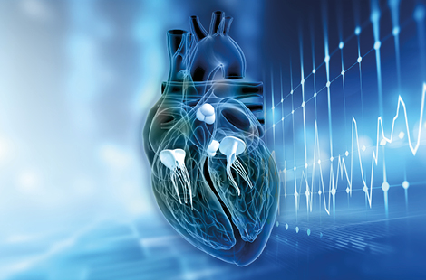 Photo of PROBLEMI VALVOLE CARDIACHE