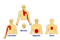 Figura A